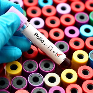 Liczba przypadków poliomyelitis na świecie wzrosła do 100 w...