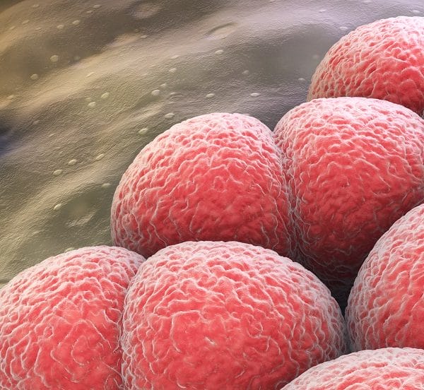 Wzrost inwazyjnych zakażeń meningokokowych wywołanych meningokokami grupy W-135