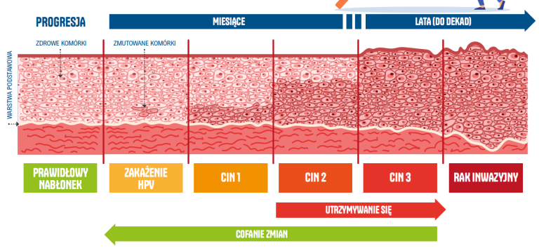 O wirusie HPV i chorobach jakie wywołuje - Szczepienia.Info